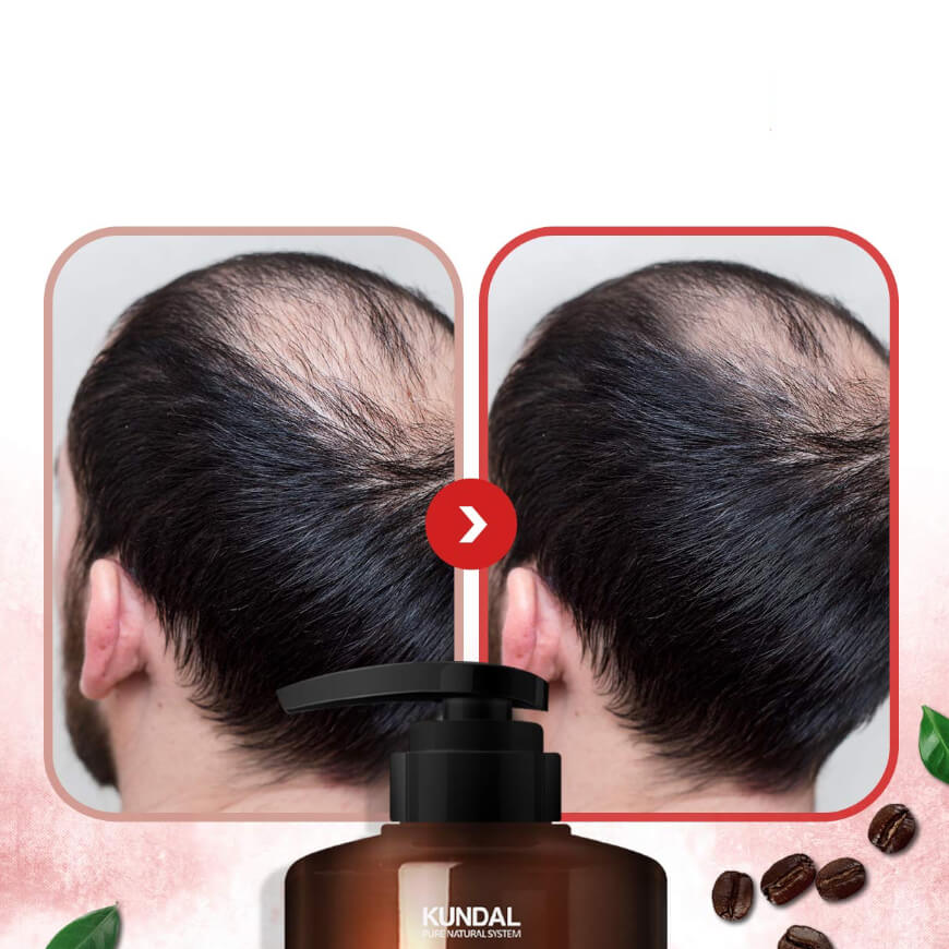 Natural Caffeine Scalp Shampoo Anticaida Cherry Blossom - KUNDAL - Sarang