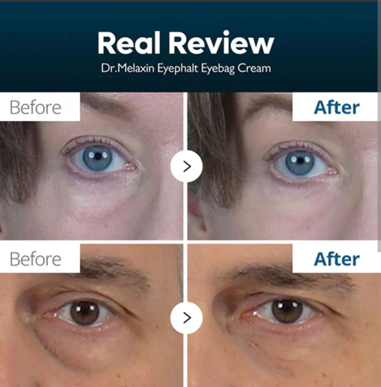 EYEPHALT EYEBAG CREAM 10ml - DR.MELAXIN - SARANG
