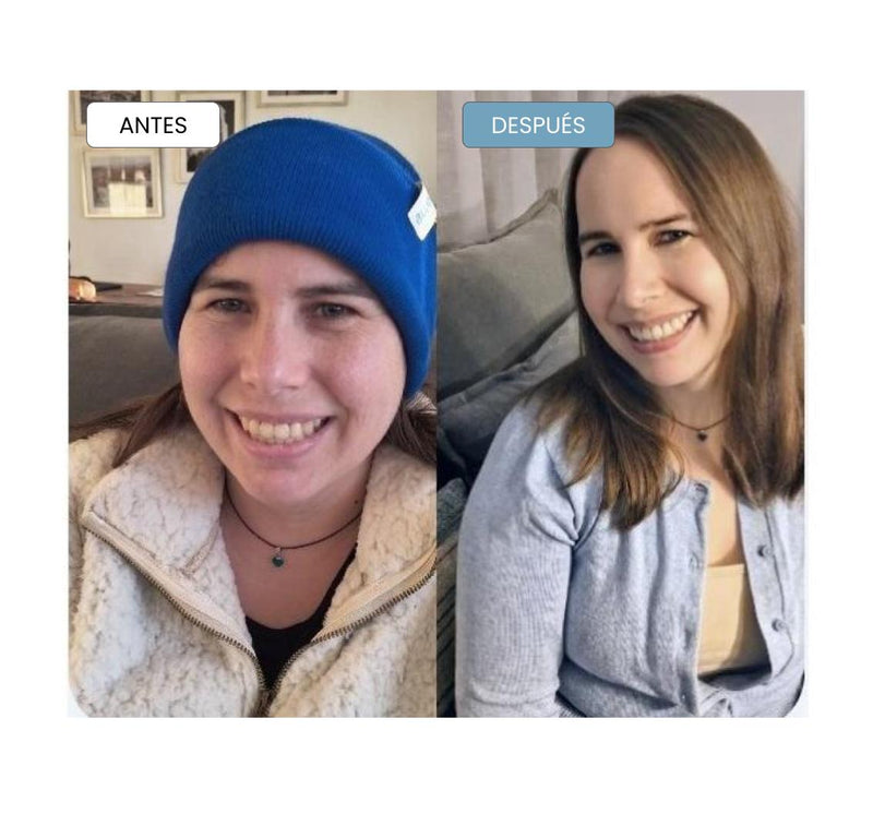 Antes / después